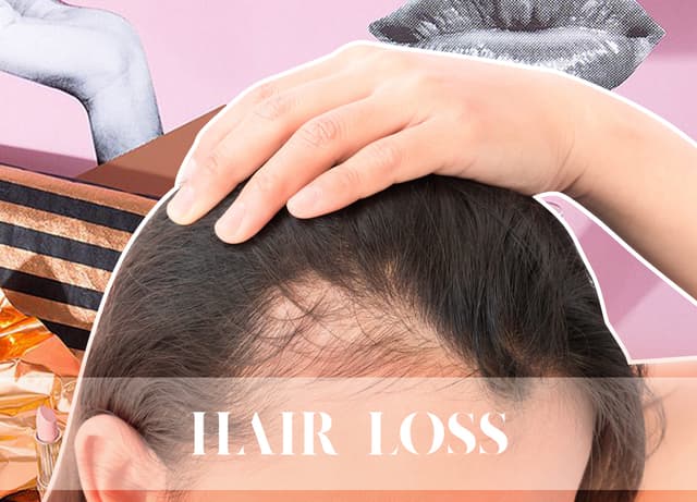 Losing Lots Of Hair - You're Not Alone In This english